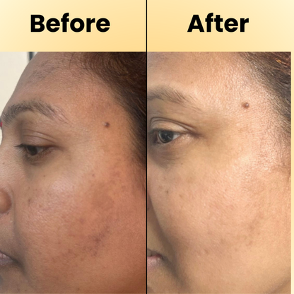 D’Radiant+ Advance Vitamin C 10% Face Serum with Alpha Arbutin and Niacinamide | 7 Active Ingrediants | Skin Brightening, Anti-Aging & Dark Spot Removal | Dermatologically & Clinically Tested(30ml)